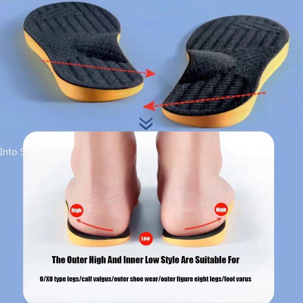Arch Support Insoles For Flat Feet Orthopedic Valgus Correction Shoe Inserts 1