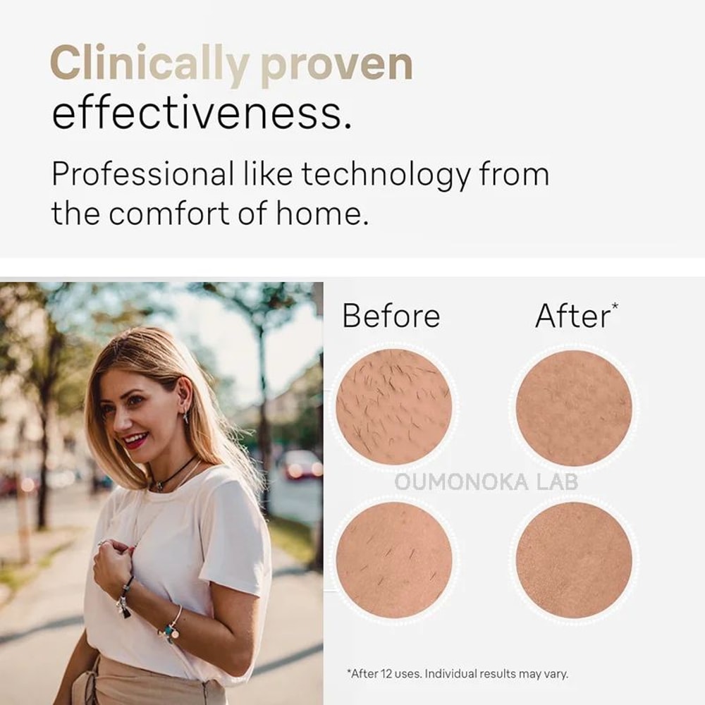 UltraSmooth Pro AtHome IPL Hair Removal Device For Women Men Permanent Hair Reduction Solution 3