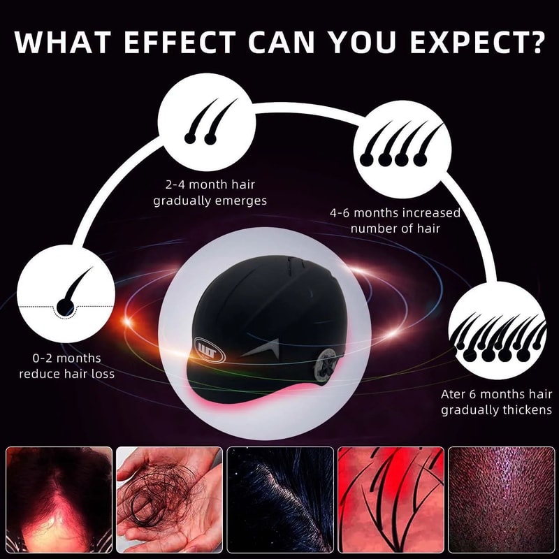 Premium 650nm LowLevel Laser Hair Growth Device AtHome LLLT Hair Regrowth Therapy 3