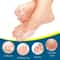 Soft Comfort Bunion Corrector Adjustable Big Toe Corrector Brace For Nighttime Relief 3