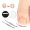 Pain Relief Ingrown Toenail Corrector Clamp Precision Curved Nail Correction Tool 0