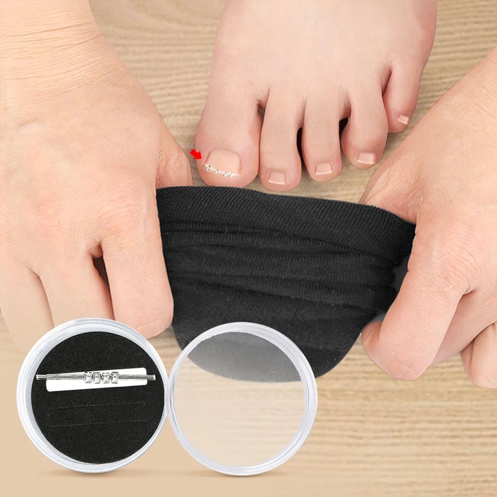 Pain Relief Ingrown Toenail Corrector Clamp Precision Curved Nail Correction Tool 3