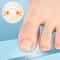 Pain Relief Ingrown Toenail Corrector Clamp Precision Curved Nail Correction Tool 5