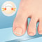 Pain Relief Ingrown Toenail Corrector Clamp Precision Curved Nail Correction Tool 5