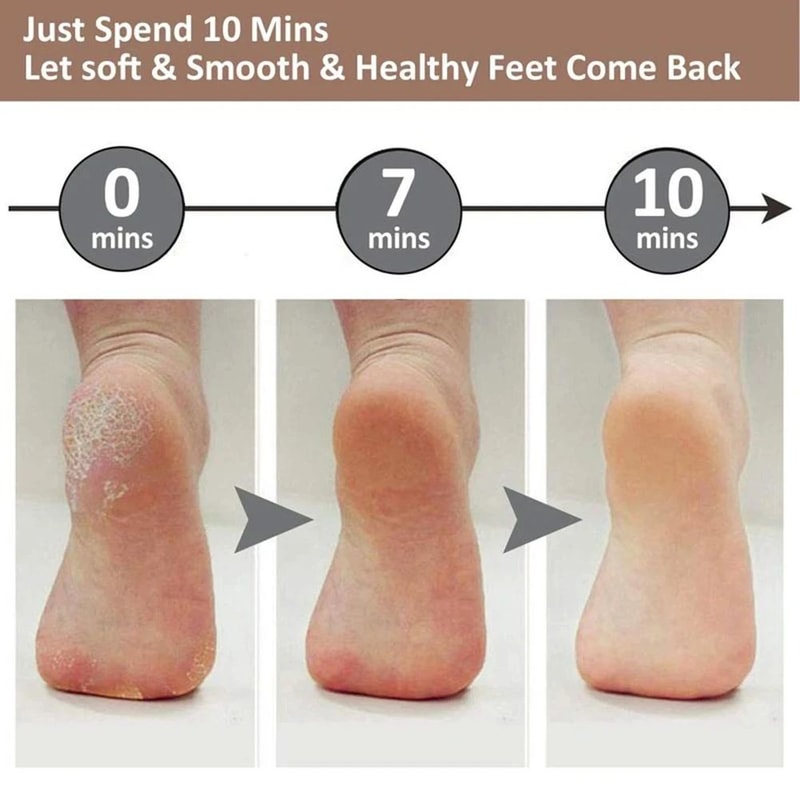SilkStep Rechargeable Electric Callus Remover For Smooth Feet 1