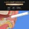 SmartSight Pro Ear Wax Remover Camera With 1296P HD Otoscope 1