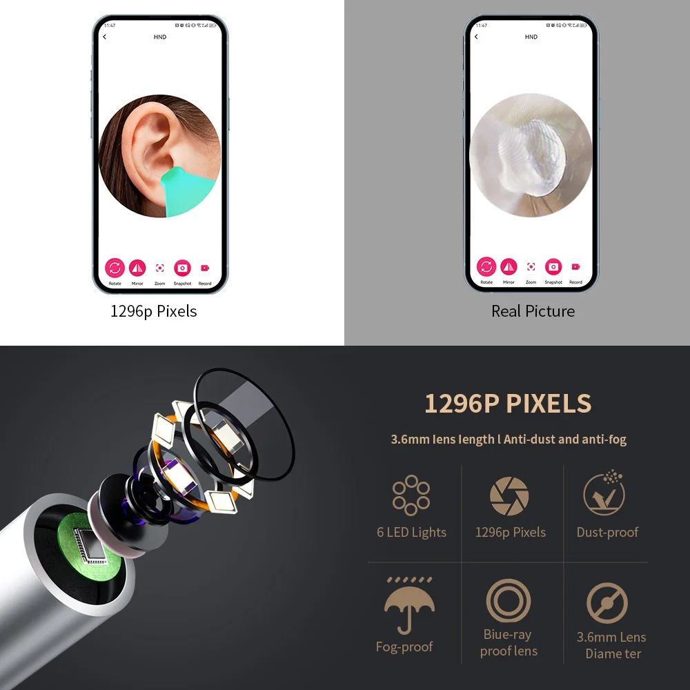 SmartSight Pro Ear Wax Remover Camera With 1296P HD Otoscope 2
