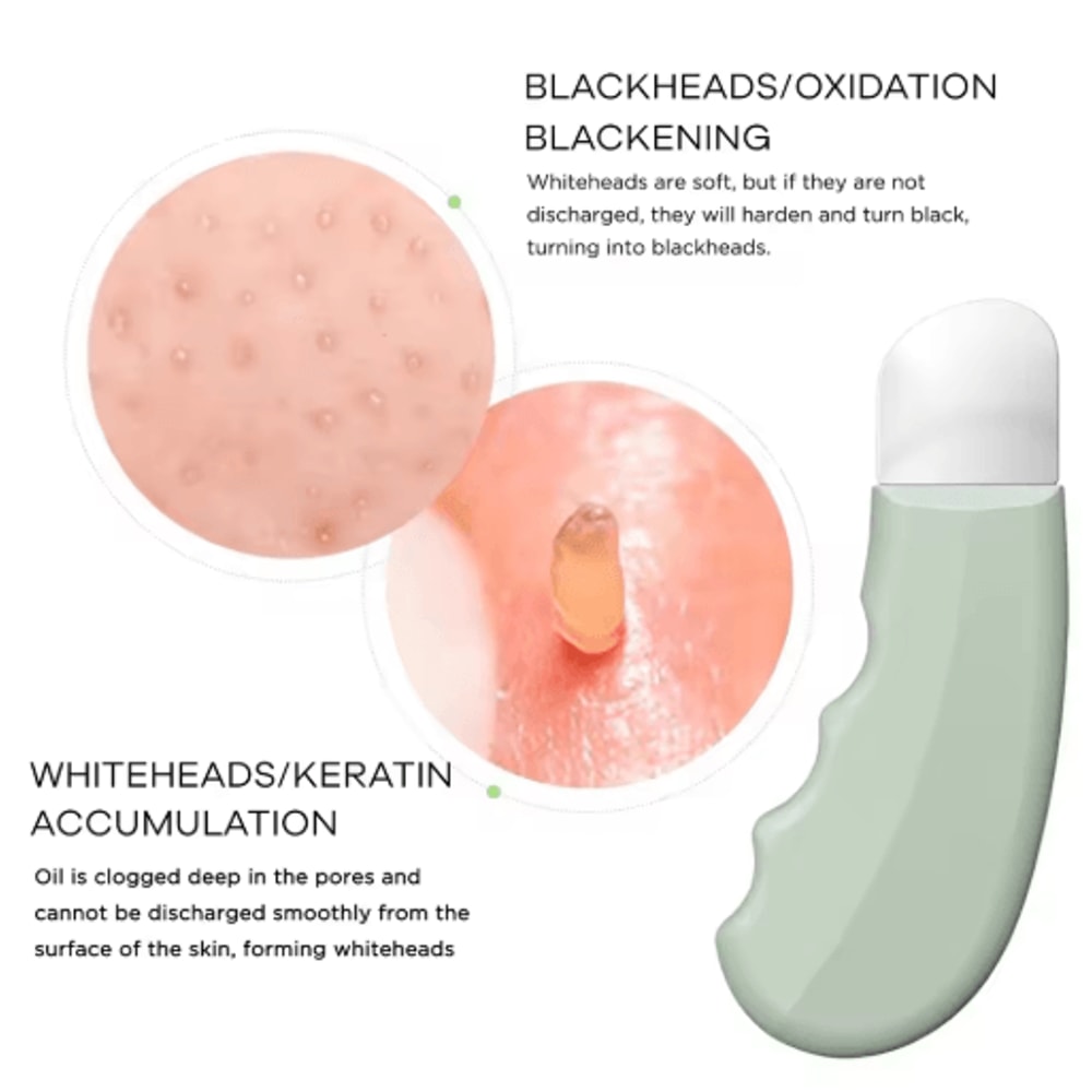 Ultra Thin Blackhead Remover Tool Stainless Steel Manual Pore Cleaner For Face And Nose 5