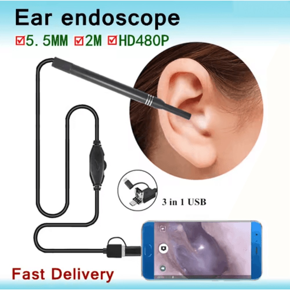 USB HD Visual Ear Cleaner Camera Intelligent Earwax Removal Tool 1