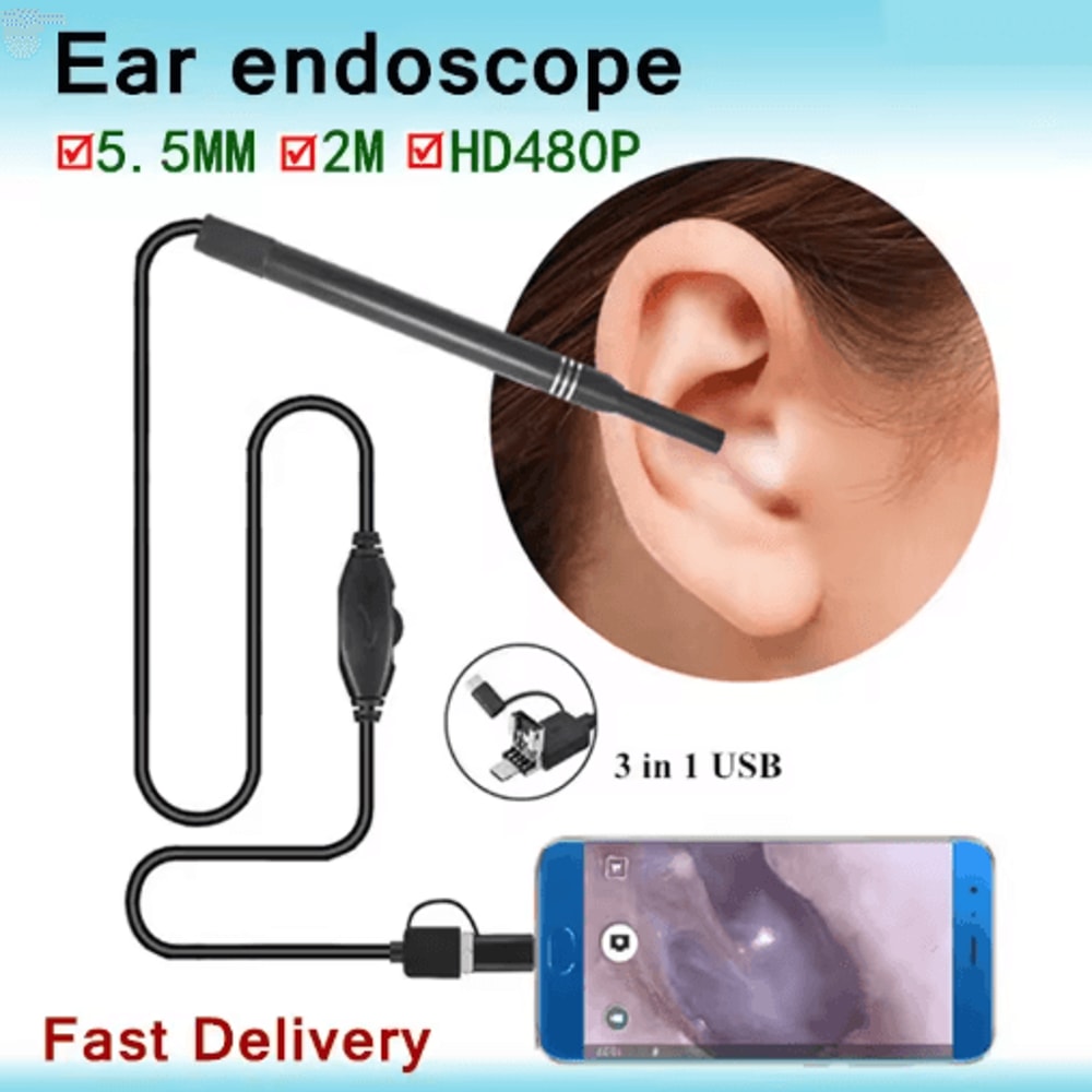USB HD Visual Ear Cleaner Camera Intelligent Earwax Removal Endoscope Tool 1