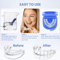 AntiSnoring Bruxism Mouth Guard Night Guard For Teeth Grinding Sleep Comfort 4