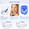 AntiSnoring Bruxism Mouth Guard Night Guard For Teeth Grinding Sleep Comfort 4