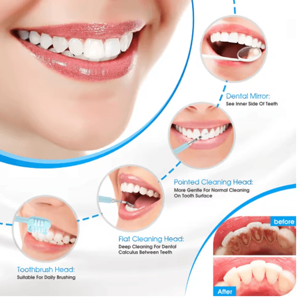 Electric Dental Calculus Remover Teeth Cleaning Whitening Scaler Device 4