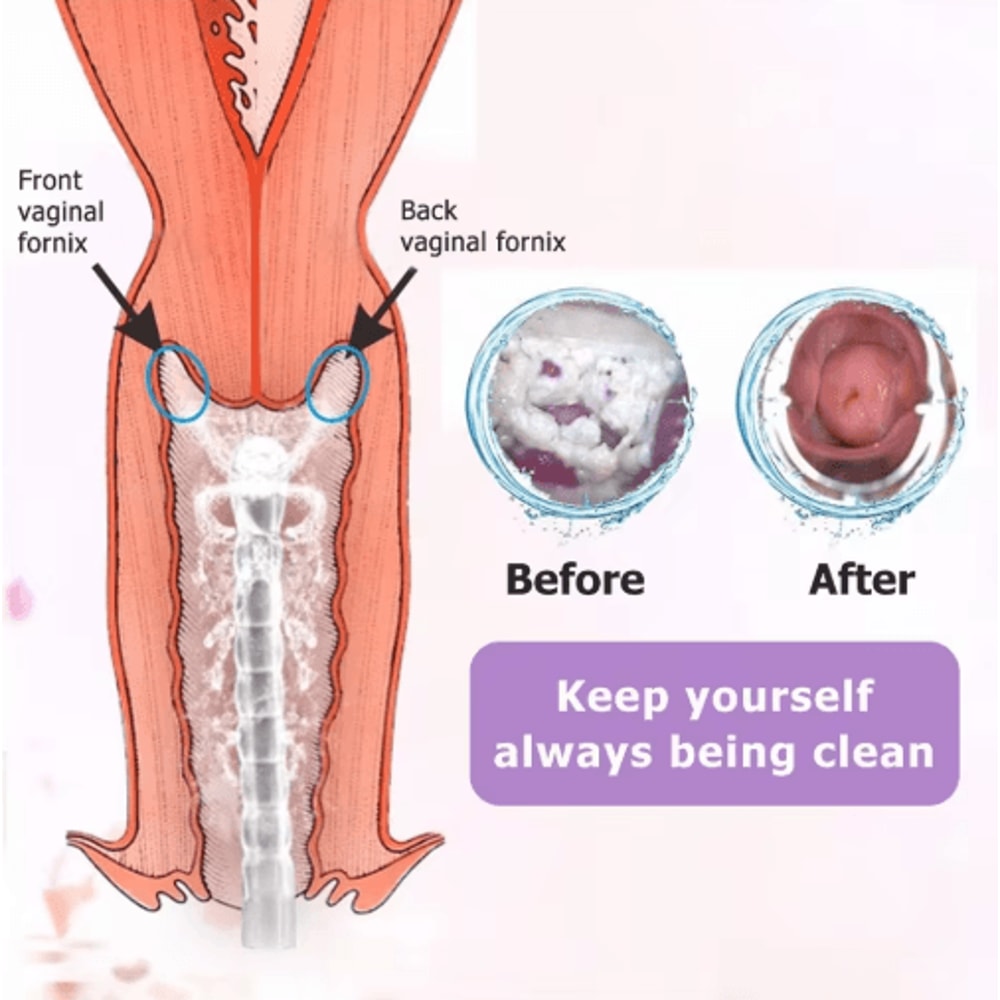 Reusable Vaginal Anal Cleansing Syringe 300600ML Personal Hygiene Flushing Kit 4