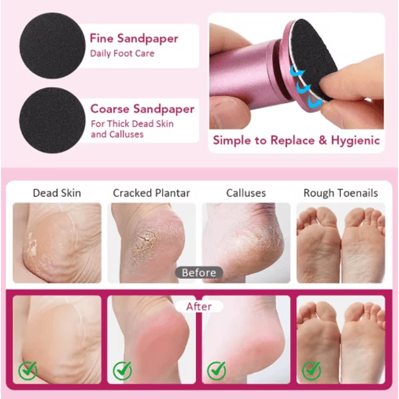 SmoothStep Pro Electric Foot Callus Remover Pedicure Tool Set 6