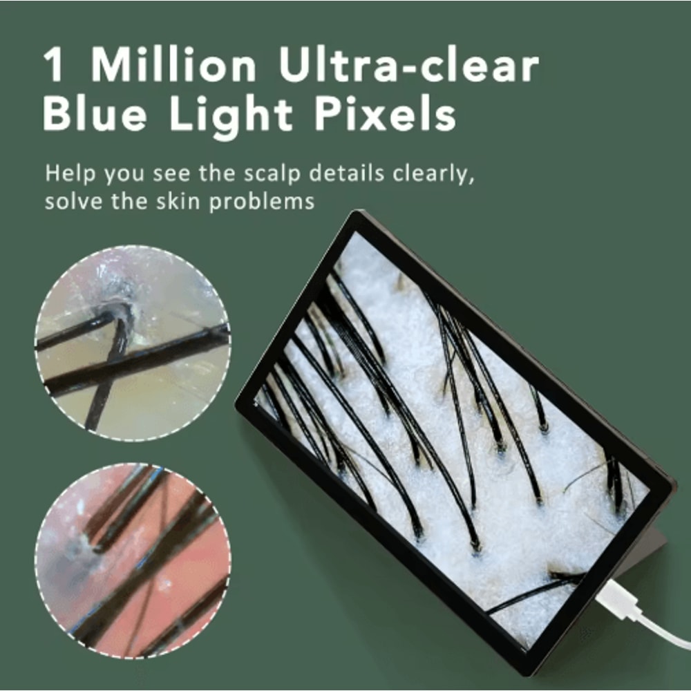 DermaScope Pro Wireless Skin Analyzer Scalp Detection Dermatoscope 4