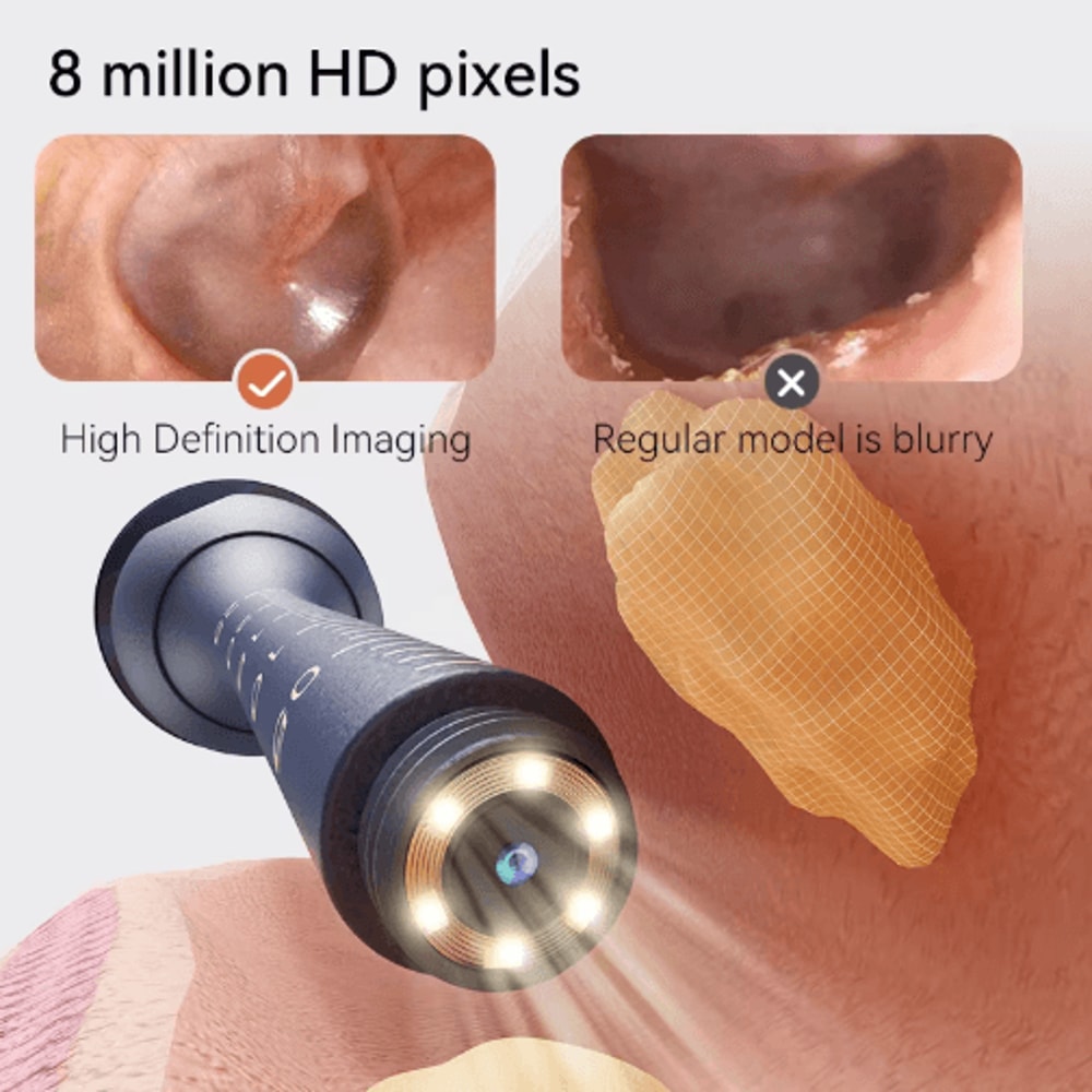 Upgraded Smart Visual Ear Wax Cleaner With 800W HD Camera And Storage Case 3