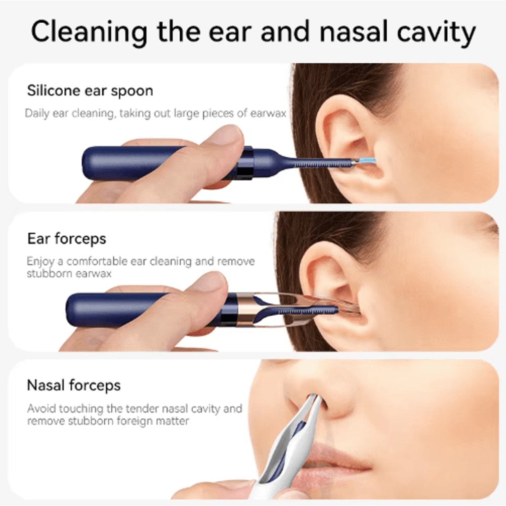 Upgraded Smart Visual Ear Wax Cleaner With 800W HD Camera And Storage Case 6