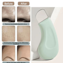 stainless steel blackhead removal tool for deep pore cleaning