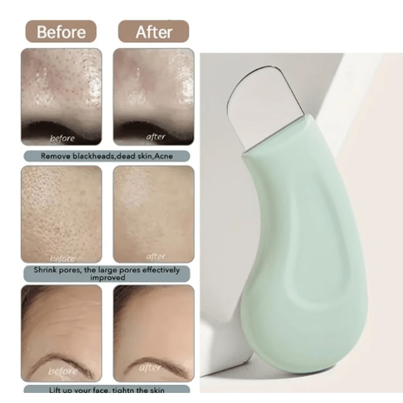 Stainless Steel Blackhead Removal Tool For Deep Pore Cleaning 0