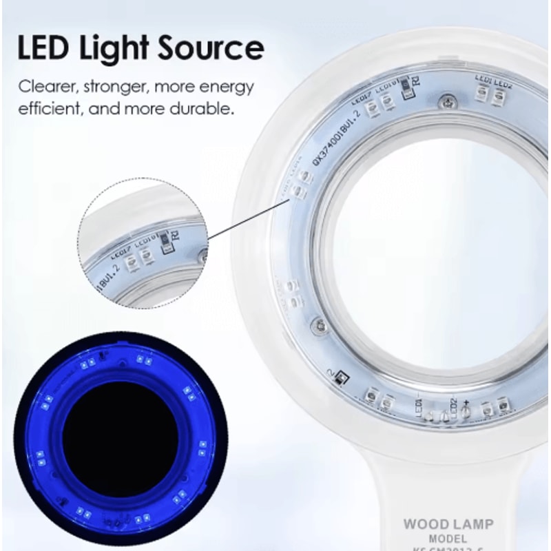ProGlow UV Woods Lamp Skin Analyzer Professional Skin Analysis Lamp For Facial Diagnostics 3