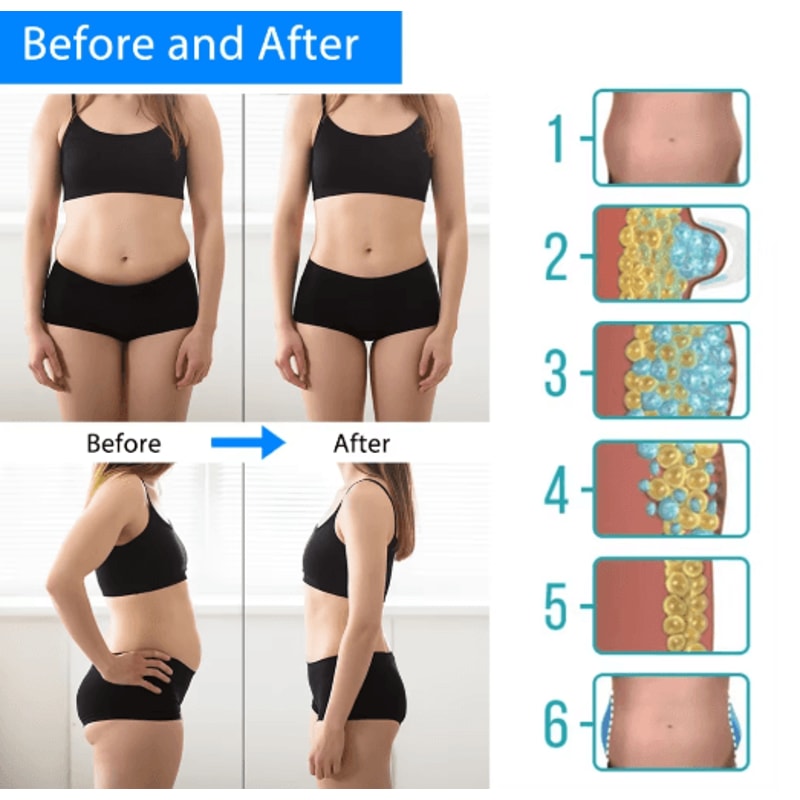 CryoSculpt Pro Cryotherapy Fat Freezing Machine Portable Body Slimming Massager For Targeted Fat Re 3