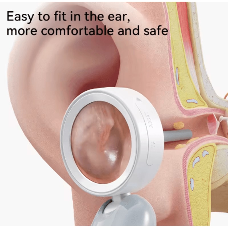 Portable Ear Camera With 138 Display HD Ear Inspection Camera With MultiUse Cleaning Kit 6