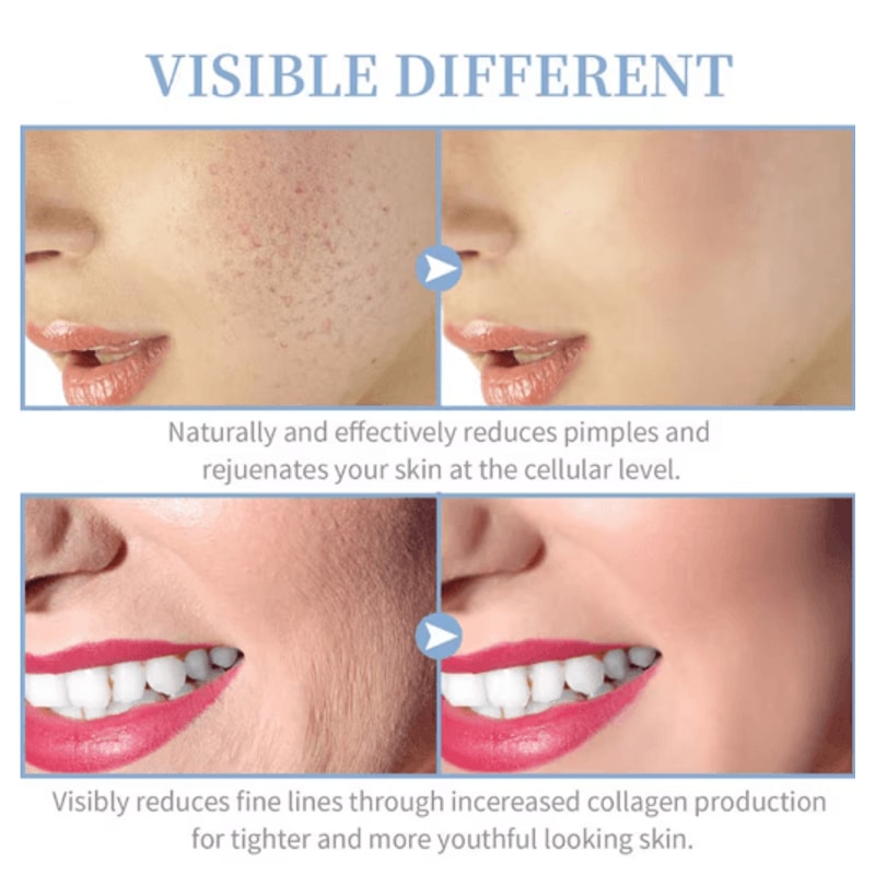 High Frequency Facial Wand Portable High Frequency Skin Device For Acne Care Skin Rejuvenation 3