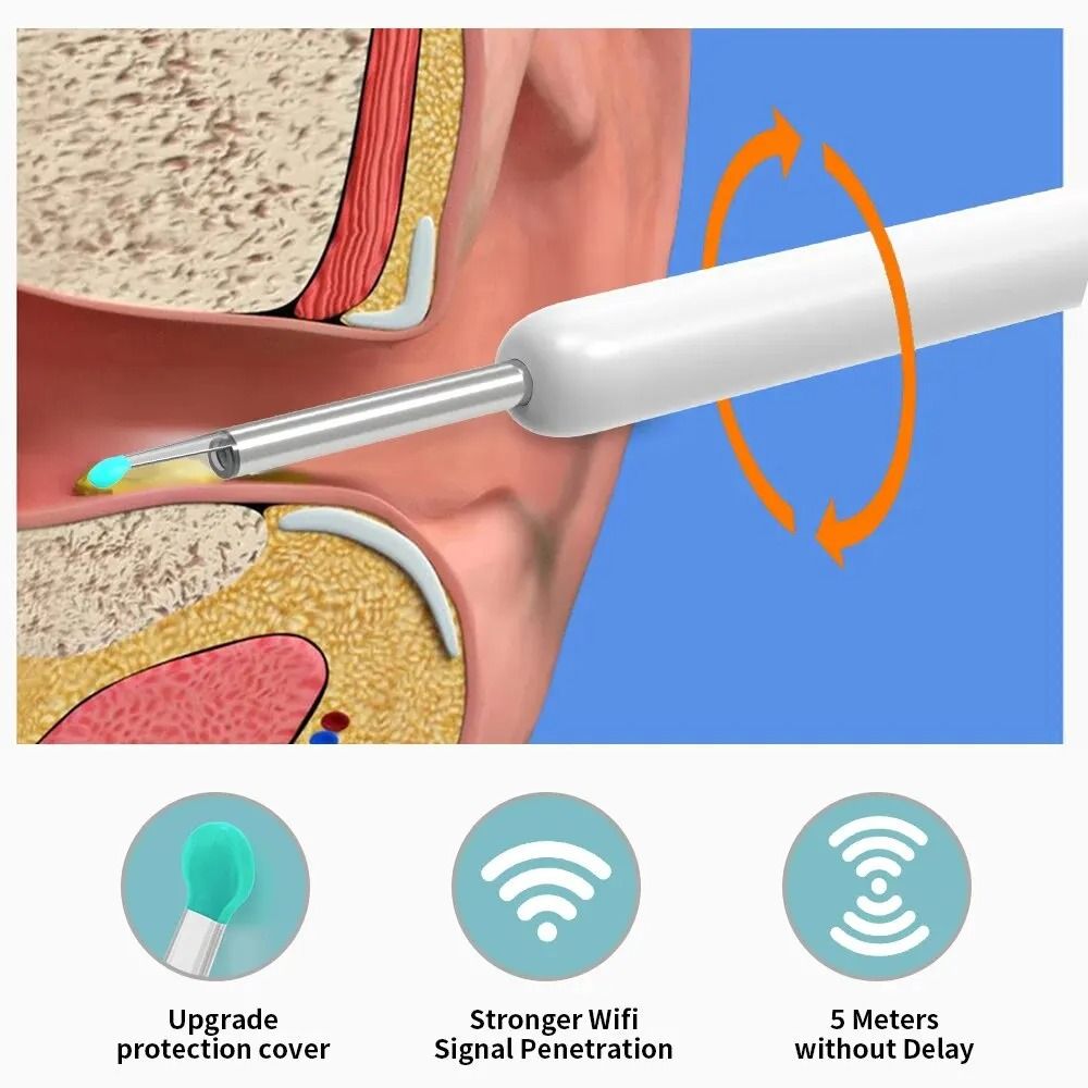 TINSOL Wireless WiFi Ear Wax Removal Otoscope Camera With LED Light 7