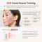 ANLAN RF Facial Device EMS Face Lifting Skin Tightening LED Beauty Massager 3