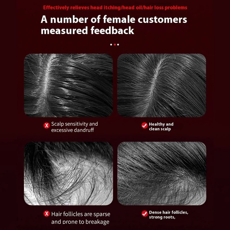 Electric Massage Comb Red Light Hair Comb Laser Scalp Comb Hair Growth Massage Brush 5