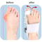 Bunion Corrector Hallux Valgus Brace Adjustable Toe Separator Toe Straightener 12