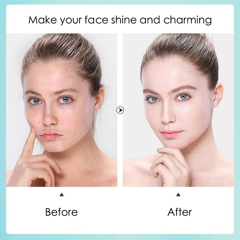 10pcs Hyaluronic Acid Hydrating Facial Sheet Mask Set 3