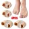 Silicone Toe Separator And Bunion Corrector Gel Toe Spacers For Shoes 3