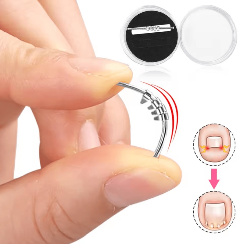 Professional Ingrown Toenail Corrector Tool Curved Clamp Pedicure Nail Straightening Kit 1