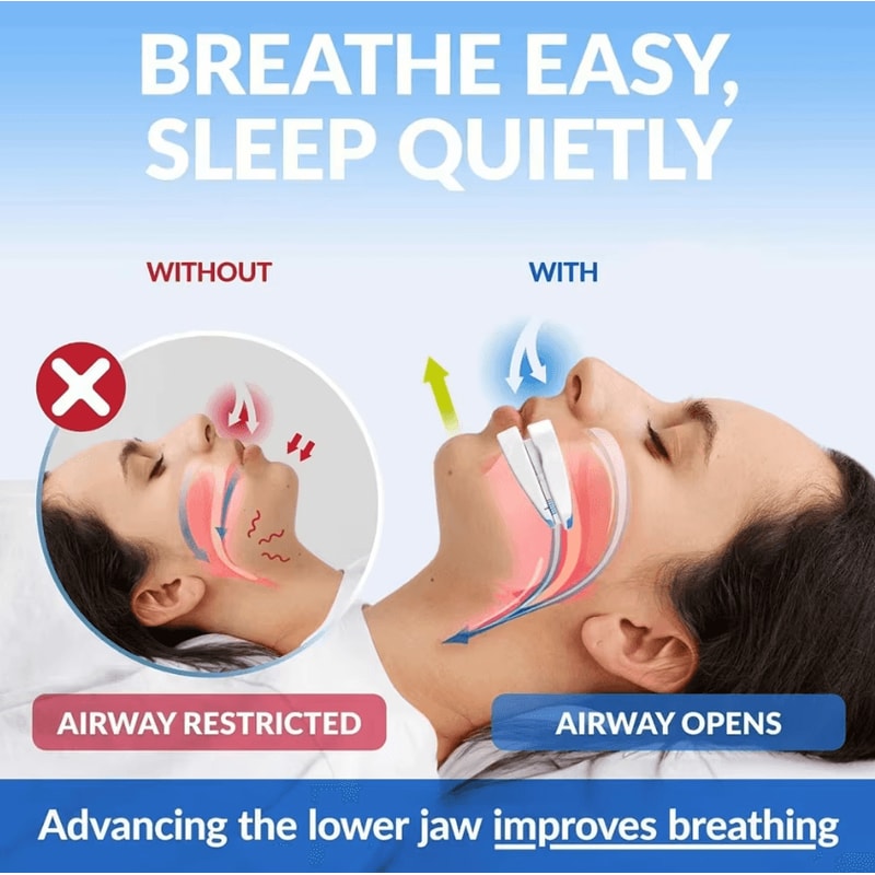 Adjustable AntiSnoring Mouth Guard Sleep Aid Bruxism Snore Stopper 2