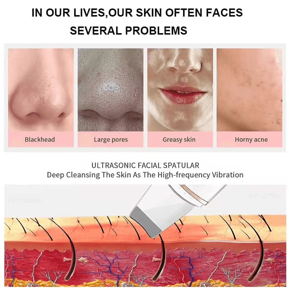 Ultrasonic Skin Scrubber Face Spatula Deep Cleansing Blackhead Remover Tool 4