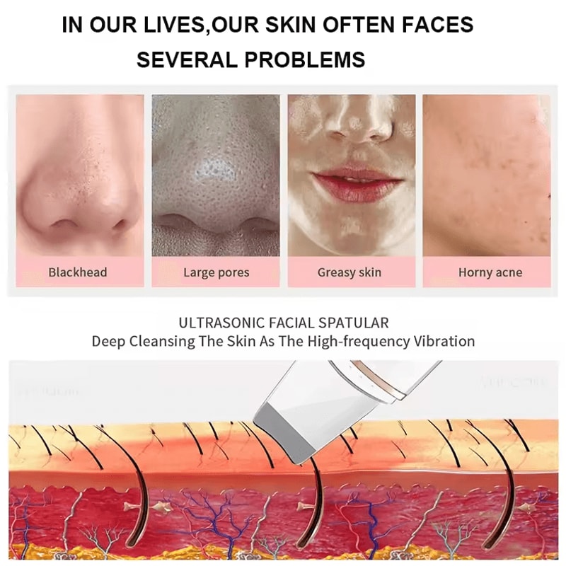 Ultrasonic Skin Scrubber Face Spatula Deep Cleansing Blackhead Remover Tool 4