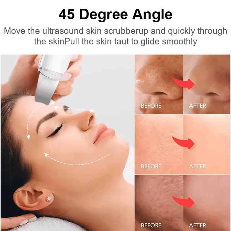 Ultrasonic Skin Scrubber Face Spatula Deep Cleansing Blackhead Remover Tool 5