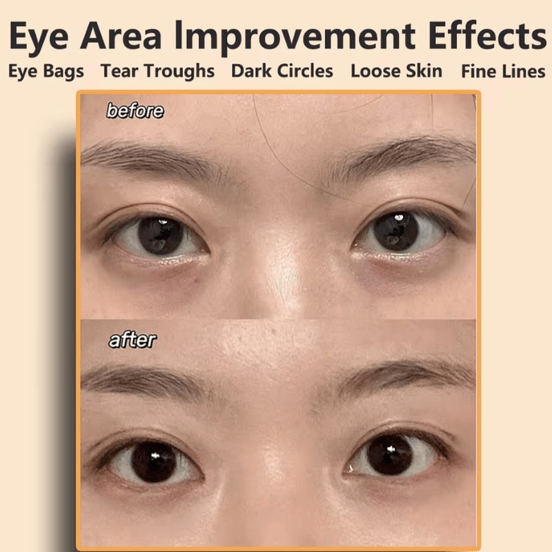 EMS Facial Massager Eye And Face Lifting Beauty And AntiWrinkle Device 1