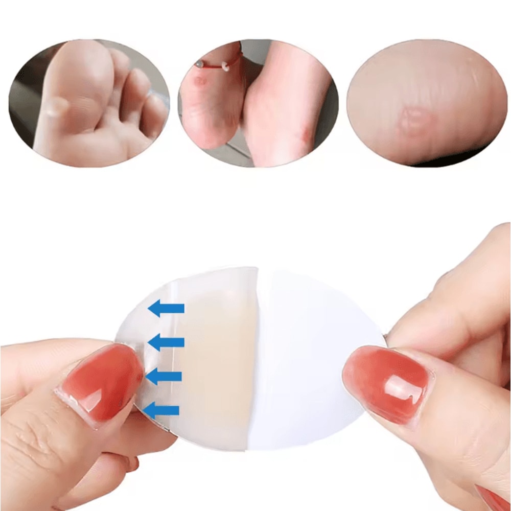 Hydrocolloid Heel Blister Patches AntiFriction Hydrocolloid Foot Patch Bandages For Outdoor Hiking 3