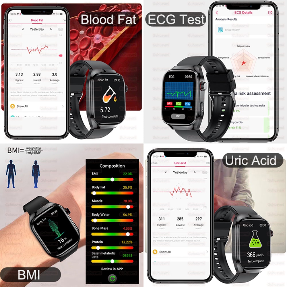 Bluetooth Call Smart Watch For Men Uric Acid Body Fat Physical Examination Smart Bracelet Five Orga 4