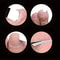 Stainless Steel Foot Care Set With Ingrown Toenail Clippers Sharp Exfoliating Knife And Dead Skin R 3