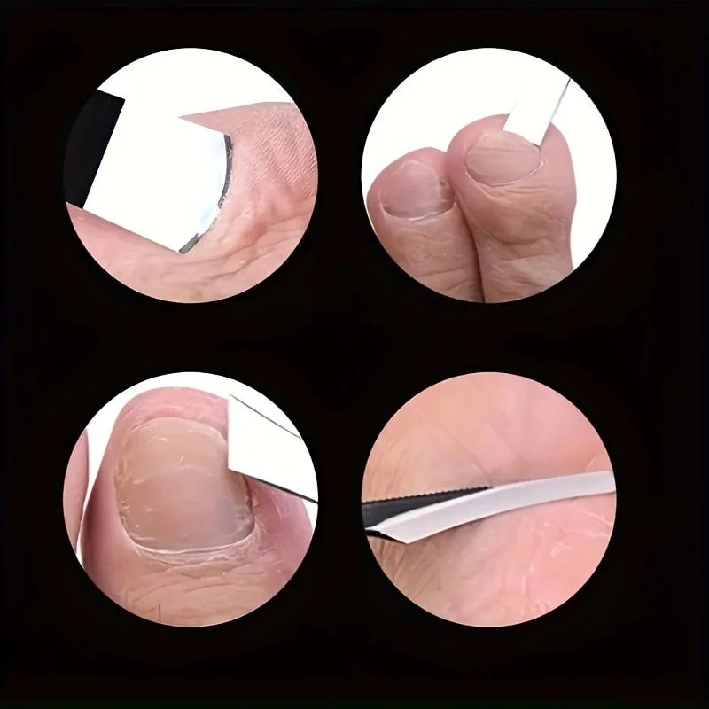 Stainless Steel Foot Care Set With Ingrown Toenail Clippers Sharp Exfoliating Knife And Dead Skin R 3