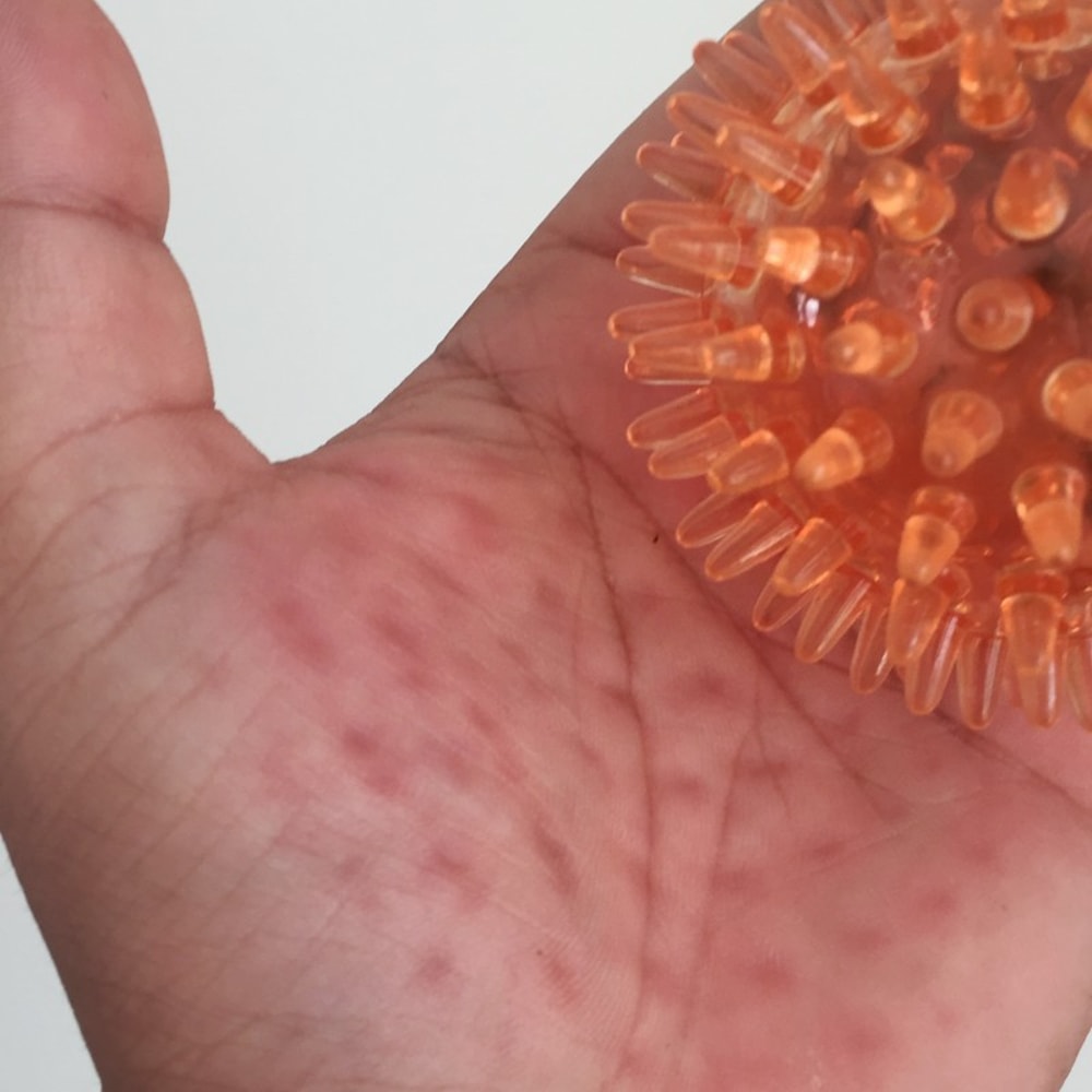 Spiky Hand Massage Ball For Grip Strength Stress Relief And Wrist Recovery 2