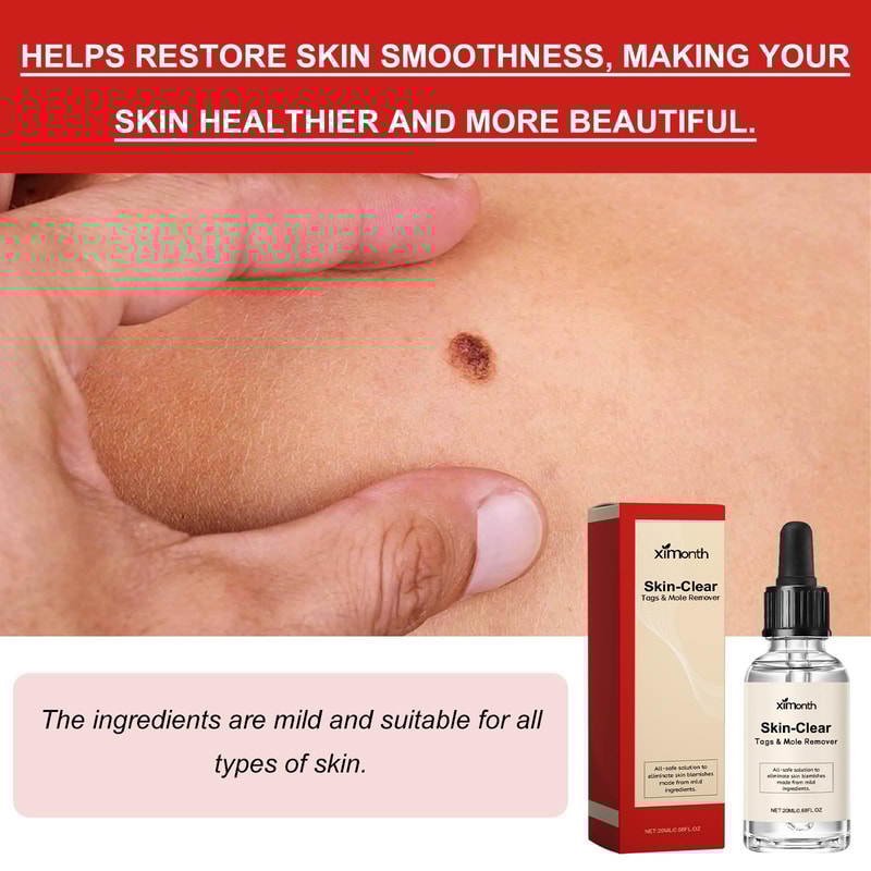 Ximonth Natural Wart Remover Liquid For Moles Skin Tags Dark Spots 20ml 4