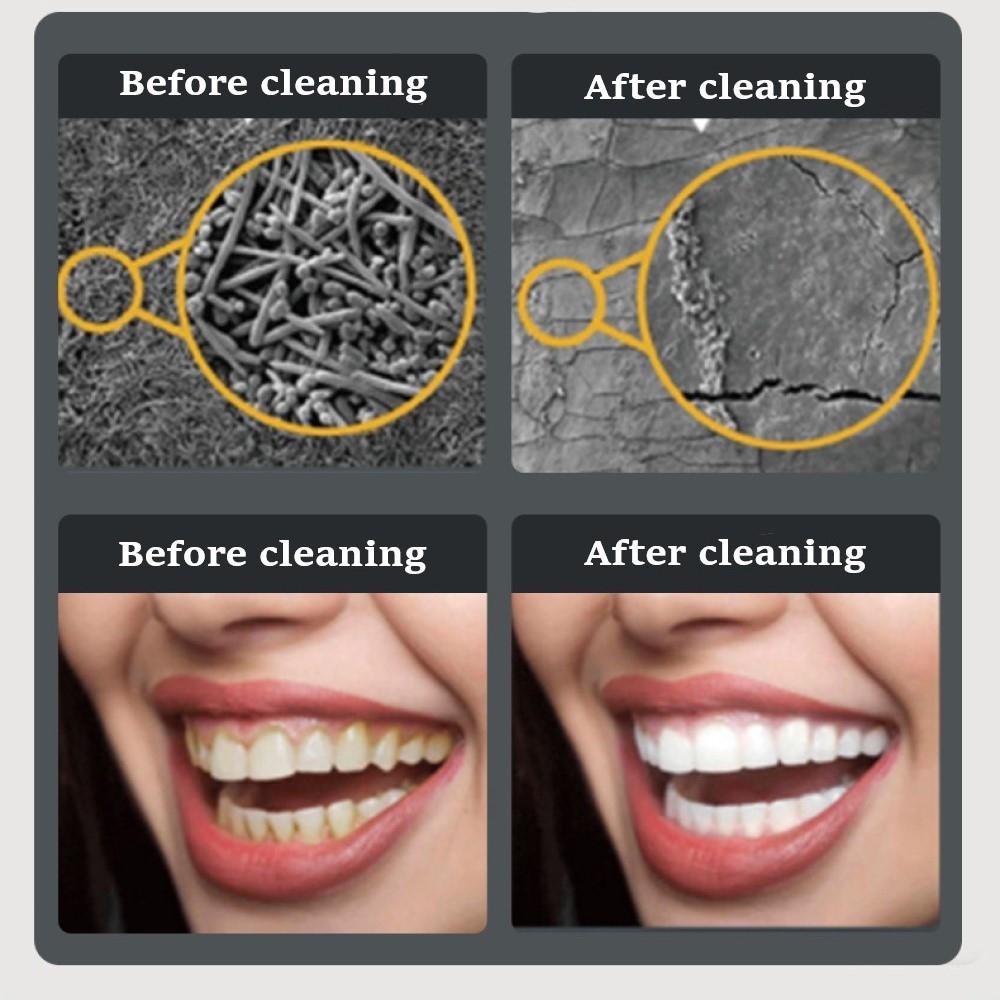 Ultrasonic Dental Scaler With LED Light For Plaque And Tartar Removal 6