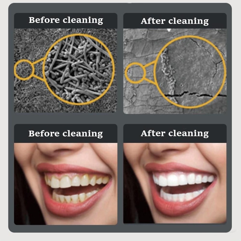 Ultrasonic Dental Scaler With LED Light For Plaque And Tartar Removal 6