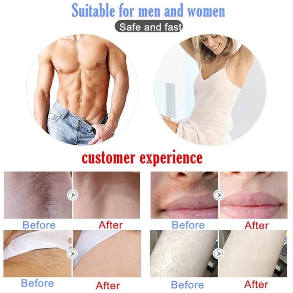HighPrecision IPL Laser Hair Removal Device For Men Women 10