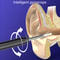 WiFi Ear Wax Removal Tool with Camera HD Ear Cleaning Endoscope